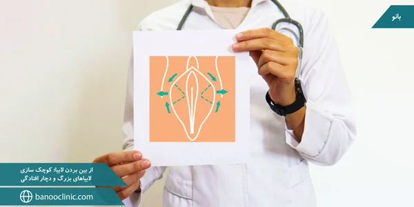 removing-the-labia;-Minimization-of-large-and-drooping-labia