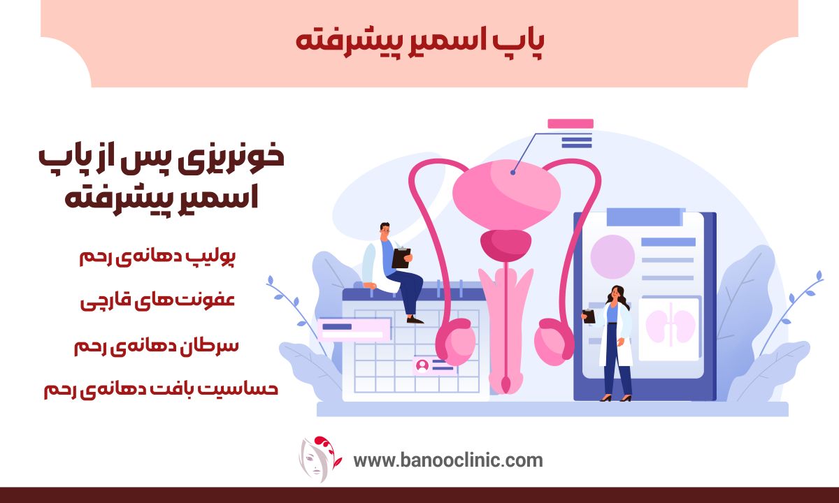 پاپ اسمیر پیشرفته