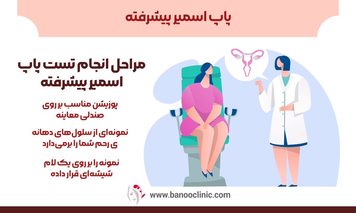 پاپ اسمیر پیشرفته