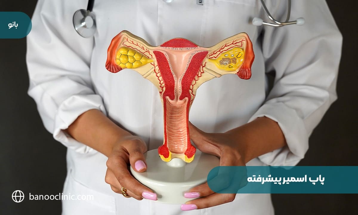 پاپ اسمیر پیشرفته