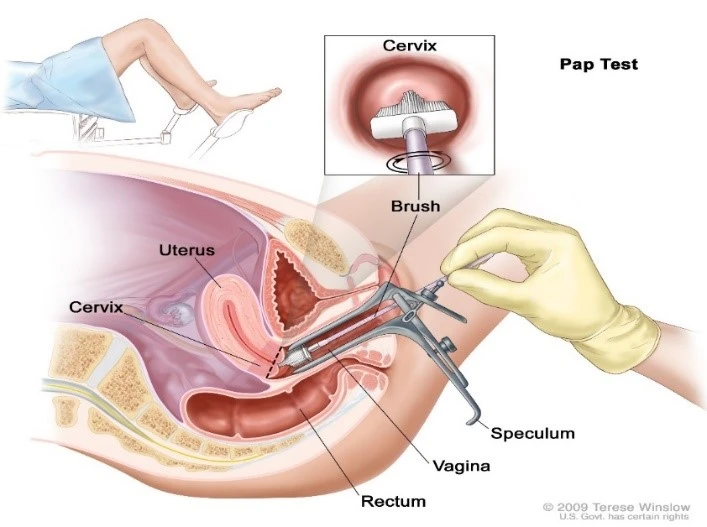 Pap-smear