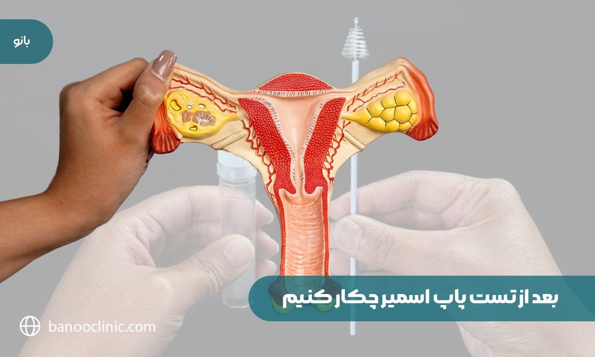 بعد از تست پاپ اسمیر چکار کنیم