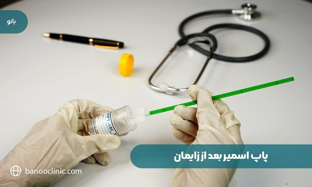 پاپ اسمیر بعد از زایمان