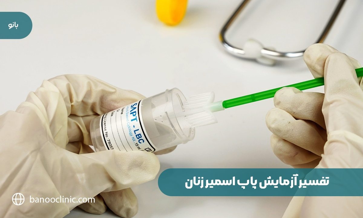 تفسیر آزمایش پاپ اسمیر زنان