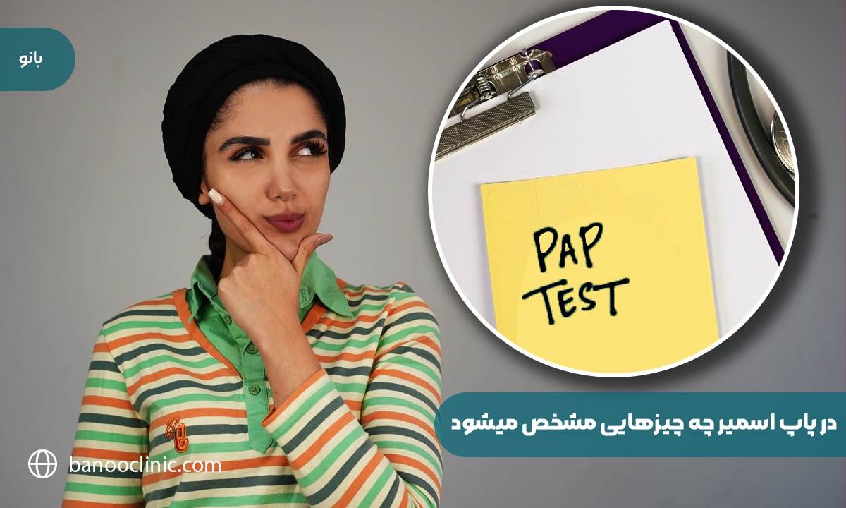 در پاپ اسمیر چه چیزهایی مشخص می‌شود